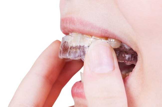 Clear Aligners in Stansbury Park, UT